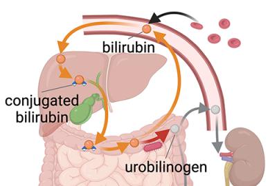 A diagram of bilirubin