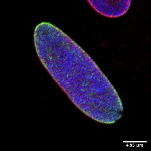 Microscope image of a blue oval on a black background with a white scale in the bottom-right corner. The edge of the oval are red and green.