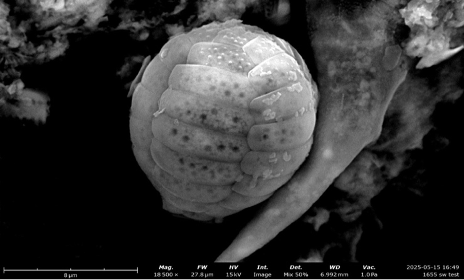 Scanning electron micrograph (SEM) showing a high-magnification, greyscale view of a rounded, spherical Paulinella murrayi test featuring patterned, scale-like rows with small pitted details, resting against organic matter on a dark background.
