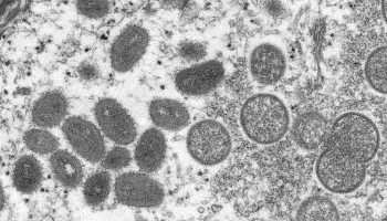 Delayed Intervention Makes Eliminating Monkeypox More Difficult