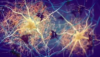 NIH Awards $12.5M for Alzheimer’s Researchers to Use AI to Scour Biobank Data