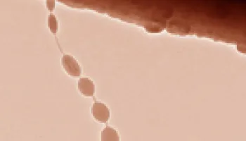 Nano 'Beads on a String' Could Advance Battery Technology