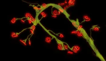 UMD-led Study Could Offer Hope to Pompe Disease Patients
