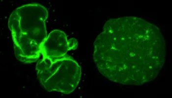 Safe, Inexpensive Chemical Found to Reverse Symptoms of Progeria in Human Cells