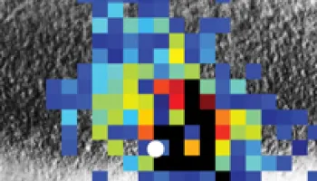 Autism May Begin Early in Brain Development