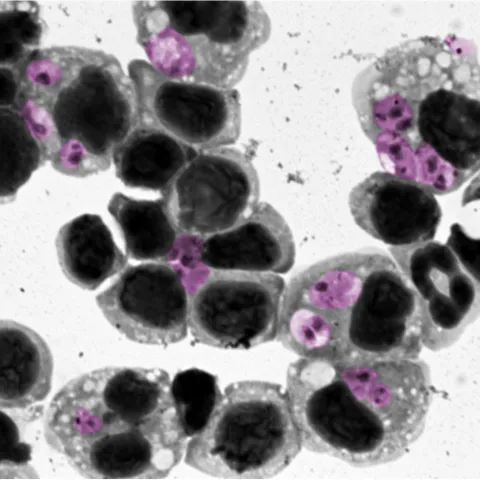 Leishmaniasis (Credit: David Mosser)