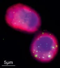 Phages, shown as small dots, are seen engulfed by alveolar macrophages