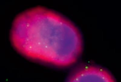 Phages, shown as small dots, are seen engulfed by alveolar macrophages