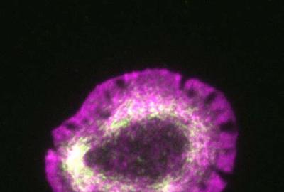 Actin and myosin shown in the actin rings of live T cells