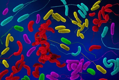 A computer-colored micrograph image of Vibrio bacteria.