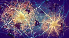 Colorful 3D illustration representing amyloid plaquing between neurons in the brain.