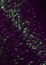 Parvalbumin expressing neurons in the gerbil auditory cortex (magenta) surrounded by perineuronal nets (green).