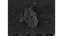 Scanning electronmicrograph of a virus infecting and blasting open a cell.