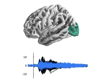 image of a brain