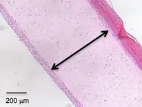 These cross-section images show three-dimensional human skin models made of living skin cells. Untreated model skin (left panel) shows a thinner dermis layer (black arrow) compared with model skin treated with the antioxidant methylene blue (right panel). A new study suggests that methylene blue could slow or reverse dermal thinning (a sign of aging) and a number of other symptoms of aging in human skin. Image credit: Zheng-Mei Xiong/University of Maryland