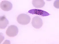 plasmodium falciparum 