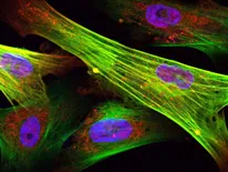 Progeria skin cells