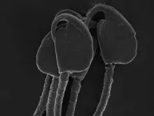 The deer mouse sperm above have wide heads which are associated with sperm aggregation and swimming as a group.