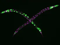 Roundworms (Caenorhabditis elegans) with a disabled eri-1 gene can lose their ability to control repetitive DNA. In the absence of eri-1, even two age-matched siblings can look dramatically different. These differences are because of variable expression from high-copy DNA (green) but not from low-copy DNA (magenta) in the worms’ intestinal cells. In worms with a functional eri-1 gene, even multi-copy DNA is expressed uniformly in all animals. 