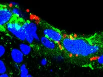 N. gonorrhoeae bacteria (red) penetrate untreated endocervical cells (blue and green)