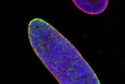 Microscope image of a blue oval on a black background with a white scale in the bottom-right corner. The edge of the oval are red and green.