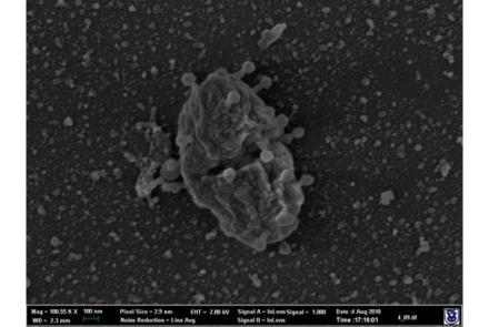 Scanning electronmicrograph of a virus infecting and blasting open a cell.