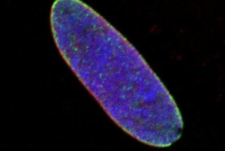 Microscope image of a blue oval on a black background with a white scale in the bottom-right corner. The edge of the oval are red and green.