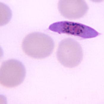 plasmodium falciparum 