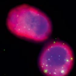 Phages, shown as small dots, are seen engulfed by alveolar macrophages