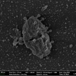 Scanning electronmicrograph of a virus infecting and blasting open a cell.