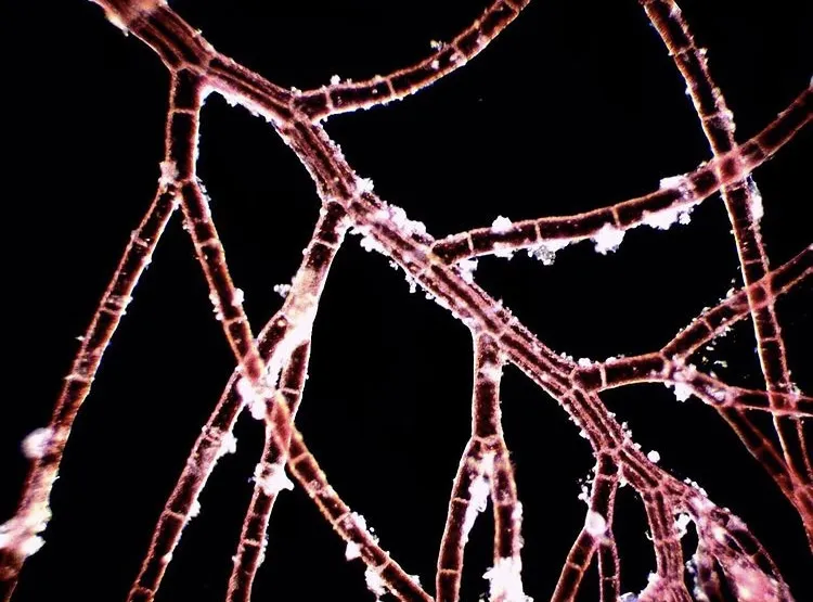 Micrograph displaying a network of branching red alga filaments with distinct cell walls glowing faintly against a pitch-black background.