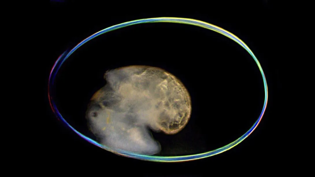 Micrograph set against a dark background, showing a transparent oval snail egg shell enclosing a developing snail embryo in its center.