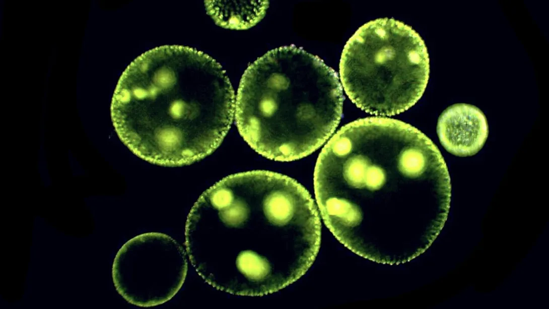 Darkfield micrograph featuring multiple vibrant green, spherical Volvox colonies floating against a black background, several containing bright, glowing daughter colonies within their hollow structures.